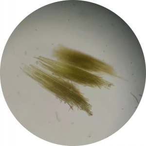 Trichodesmium